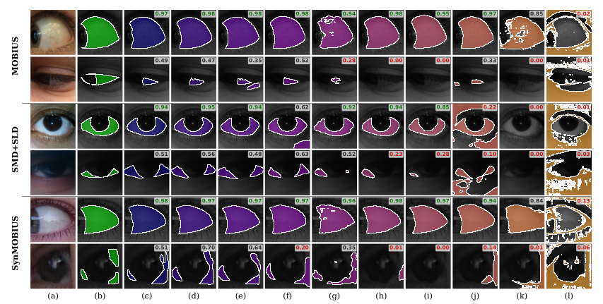 Label-Efficient Sclera Segmentation with Foundation Models: SSBC 2026 teaser